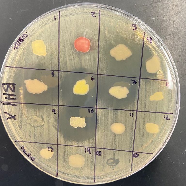 Bacteria isolated from soil samples were tested for their ability to produce antibiotics that inhibited the growth of bacterial relatives...